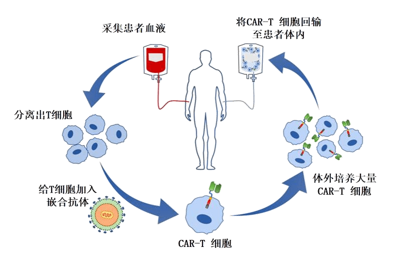 细胞免疫疗法—CAR-T,干细胞免疫修复疗法